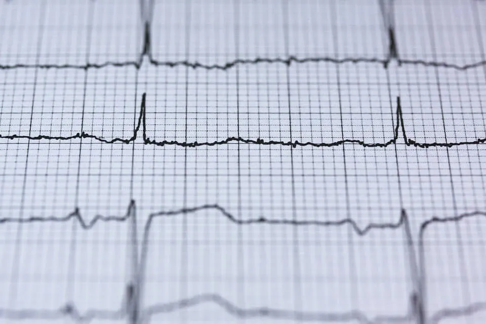 Heart-Beat